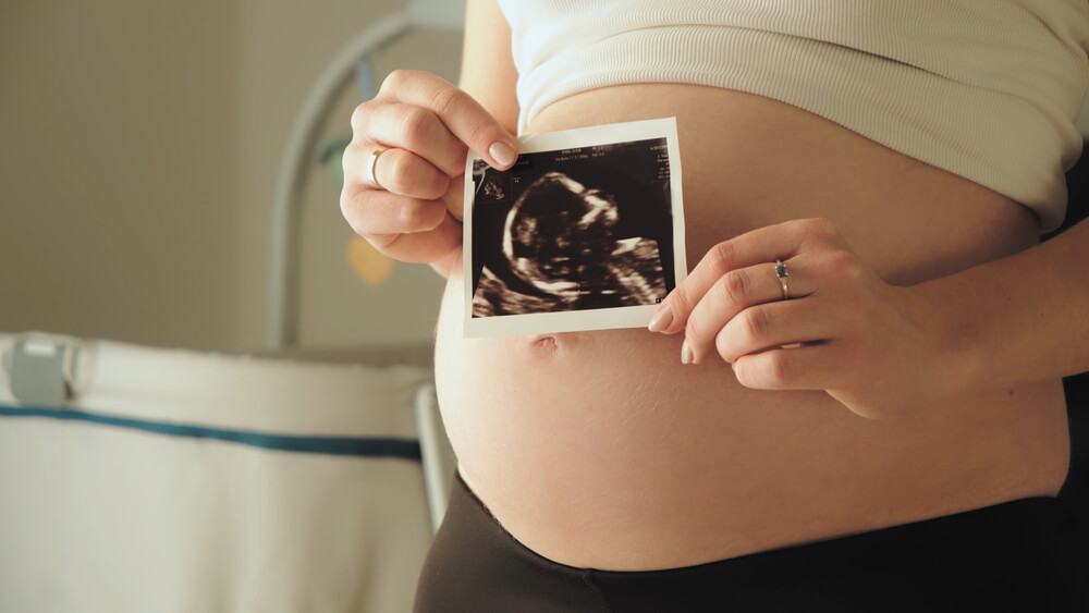 Pregnant Woman Middle Body Section Holding the Echography Photograph of Her Baby in Front of Her Belly.