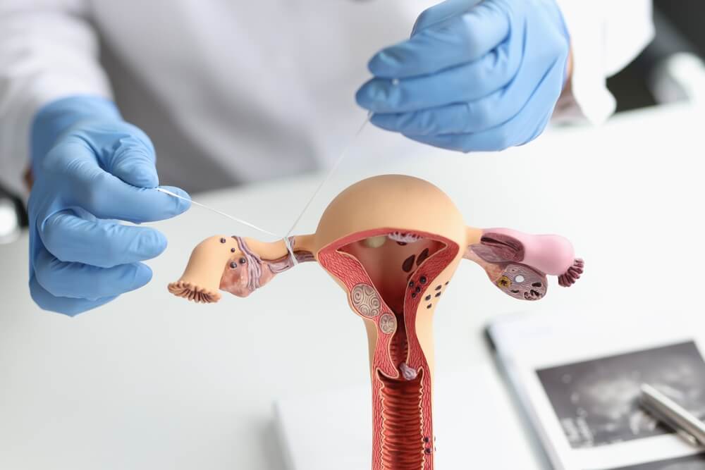 Doctor Gynecologist Ligates Fallopian Tubes on Example of Layout Female Reproductive System
