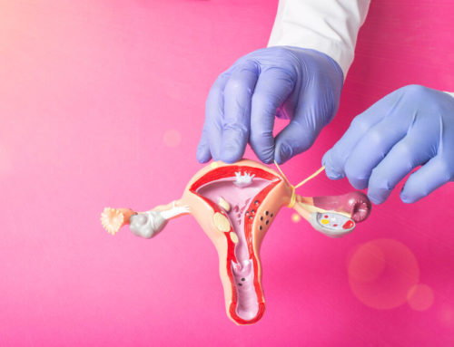 Tubal Ligation – Should You Get Your Tubes Tied?