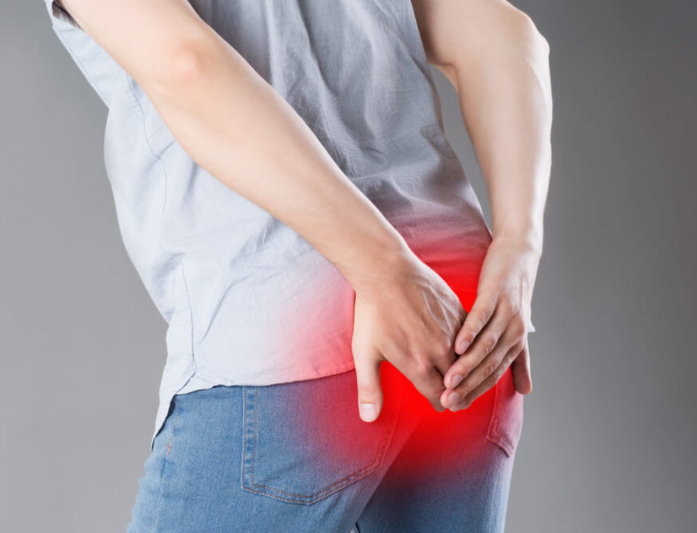 Pit Picking Pilonidal Cyst Advanced Surgical Physicians