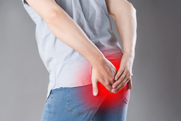 Pilonidal Cyst Causes Symptoms Removal And Treatments Advanced