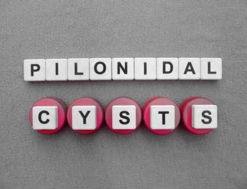 Everything You Should Know About Pilonidal Cyst Pit Picking