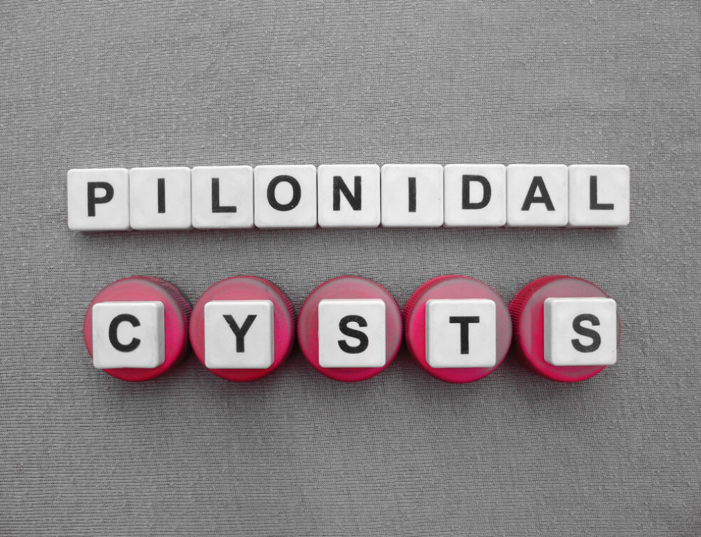 Everything You Should Know About Pilonidal Cyst Advanced Surgical