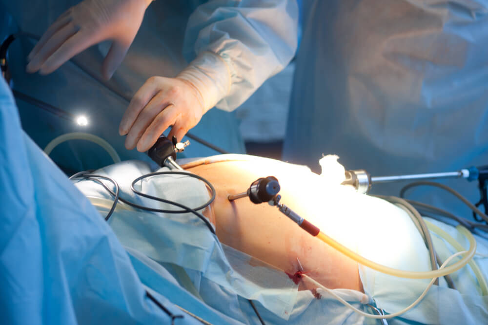 When Is Gallbladder Surgery Necessary? Advanced Surgical Physicians