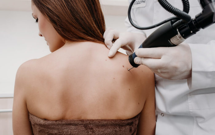 Removal of Benign Tumors in Cosmetic Salon.