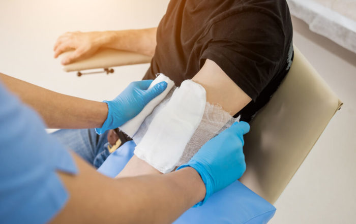 Nurse Dressing Wound for Patient’s Hand With Burn Injury. Medical Background