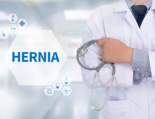 Incisional Hernia: Symptoms and Possible Complications