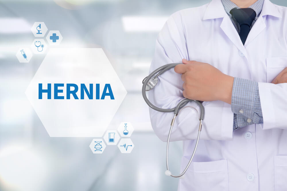Hernia Medicine Doctor Working With Computer Interface as Medical