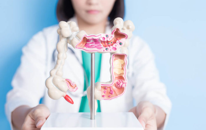 Beauty Woman Doctor With Colorectal Cancer Concept on the Blue Background