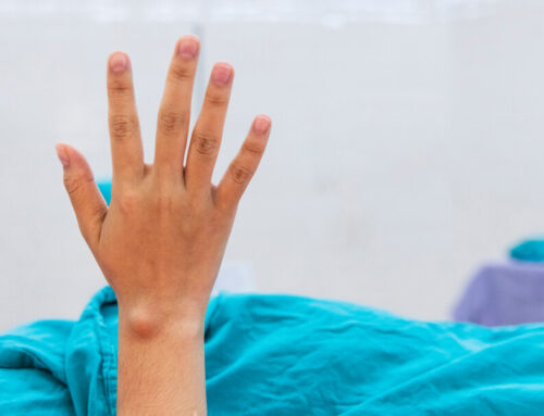 Lipoma – Treatment, Symptoms, and Diagnosis