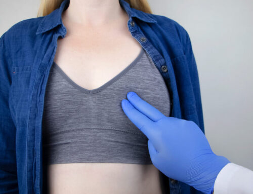 When to Worry: Understanding Breast Cyst Symptoms and Tumor Differences