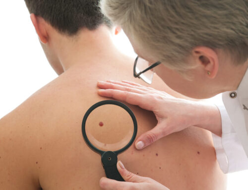 Skin Cells Under the Microscope: A Journey into Skin Cancer Types