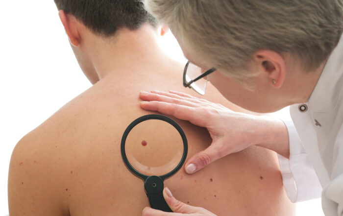 Dermatologist examines a skin of male patient