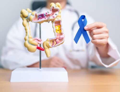 Colorectal Cancer Symptoms And Causes