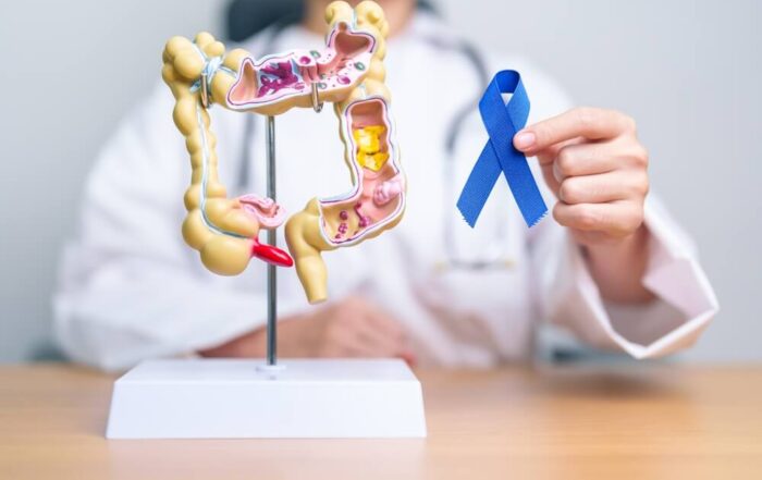 Doctor holding Blue ribbon with human Colon anatomy model.