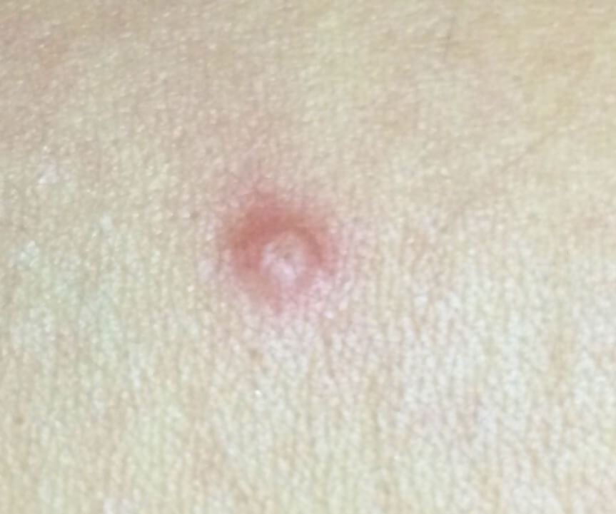 A close-up shot of a molus. A close-up shot of a molus.