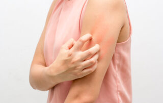 Women Scratch the Itch With Hand