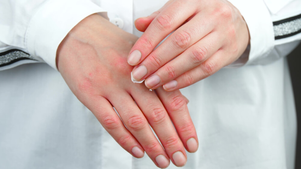 Woman Applying Cream to Hands