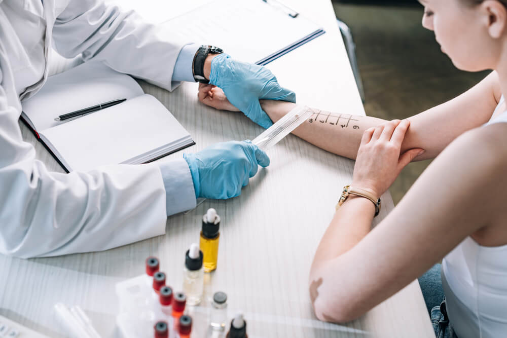 Overhead View of Allergist Holding Ruler Near Marked Hand of Woman