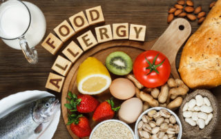 Allergy Food as Almonds, Milk, Pistachios, Tomato, Lemon, Kiwi, Trout, Strawberry, Bread, Sesame Seeds, Eggs, Peanuts and Bean on Wooden Table