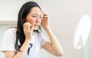 Asian Young Woman, Girl Looking Into Mirror With Allergy Reaction