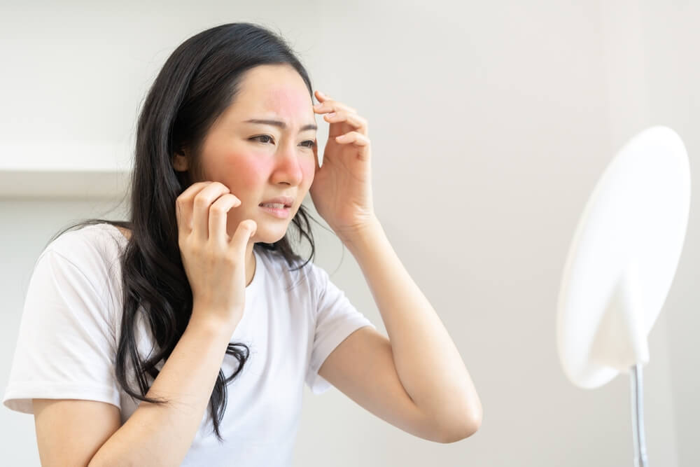 Asian Young Woman, Girl Looking Into Mirror With Allergy Reaction