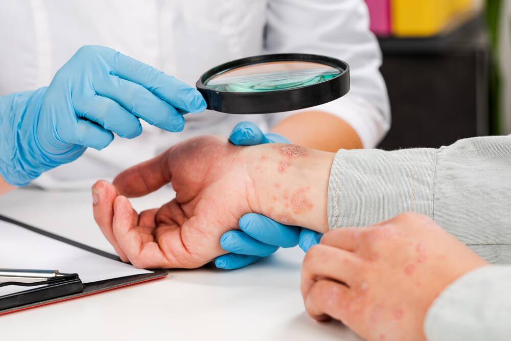 A Dermatologist Wearing Gloves Examines the Skin of a Sick Patient
