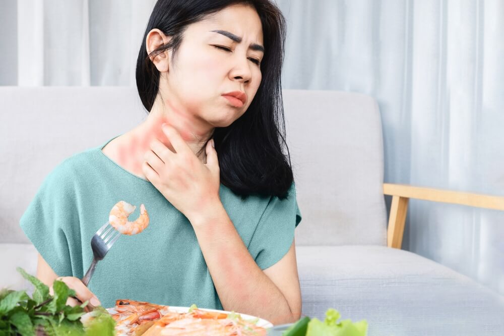 Asian Woman Have Allergy Reactions To Shrimp Or Seafood Have Problems With Rash Itching And Hives On The Skin
