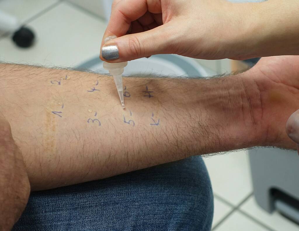 Food-Allergy-testing