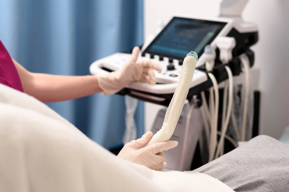 A Gynecologist Holds in His Hand a Transvaginal Ultrasound Scanner With a Gel for Vaginal Examination of a Woman.