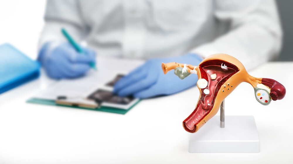 Gynecology Concept. Anatomical Uterine, Vagina Model With Pathologies, Close-up.