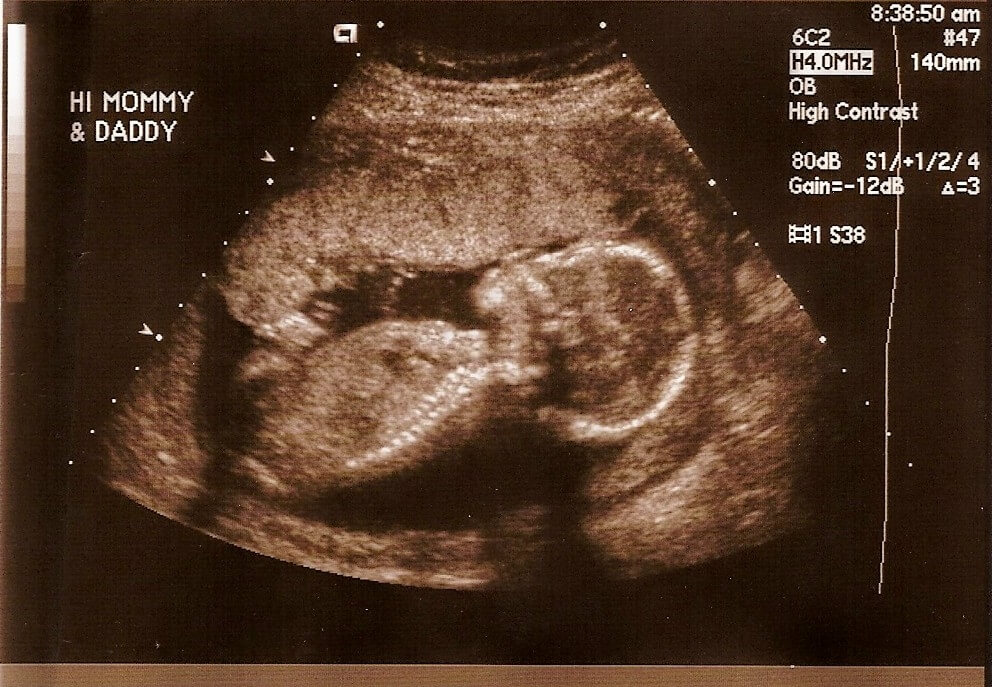 bigstock-Wk-Ultrasound-2370028 | Beacon Hallandale