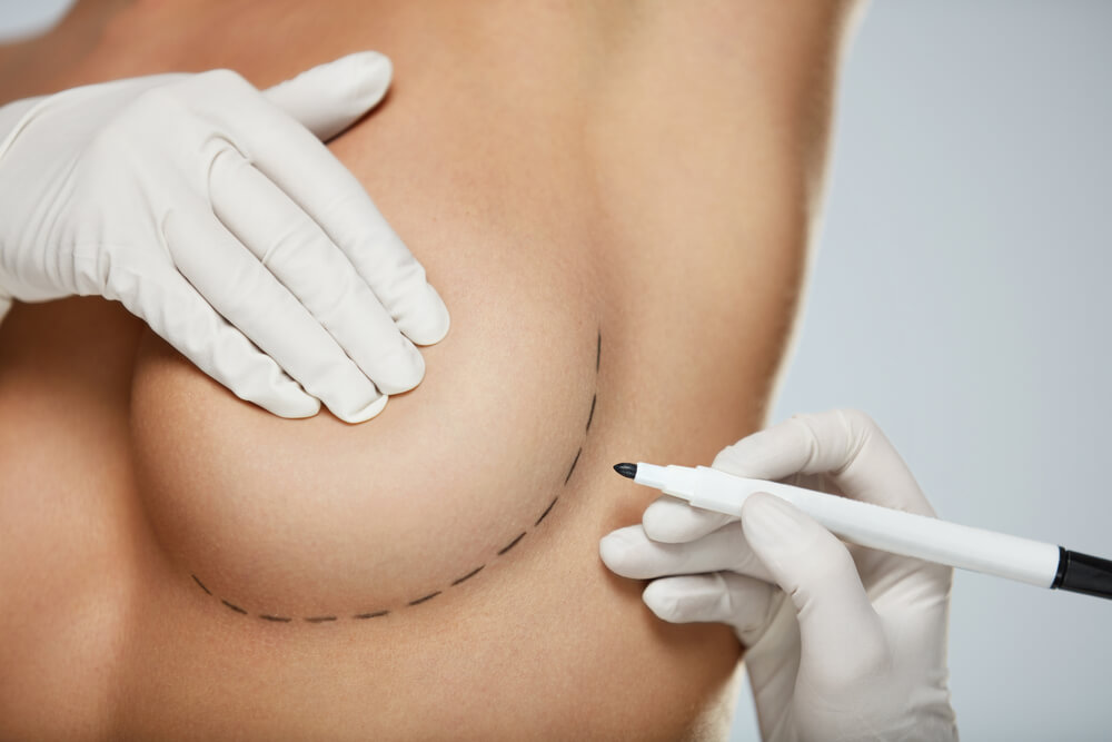 5 Types of Breast Surgery & What They Can Do for You