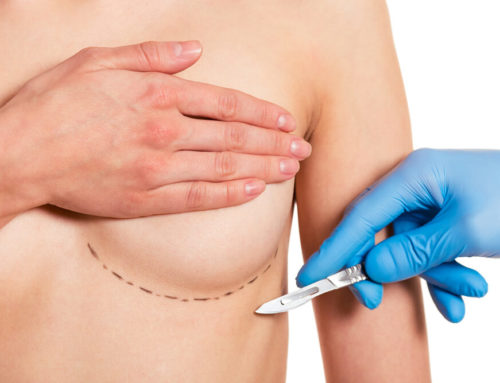 How to Find the Best Breast Surgeon in Miami