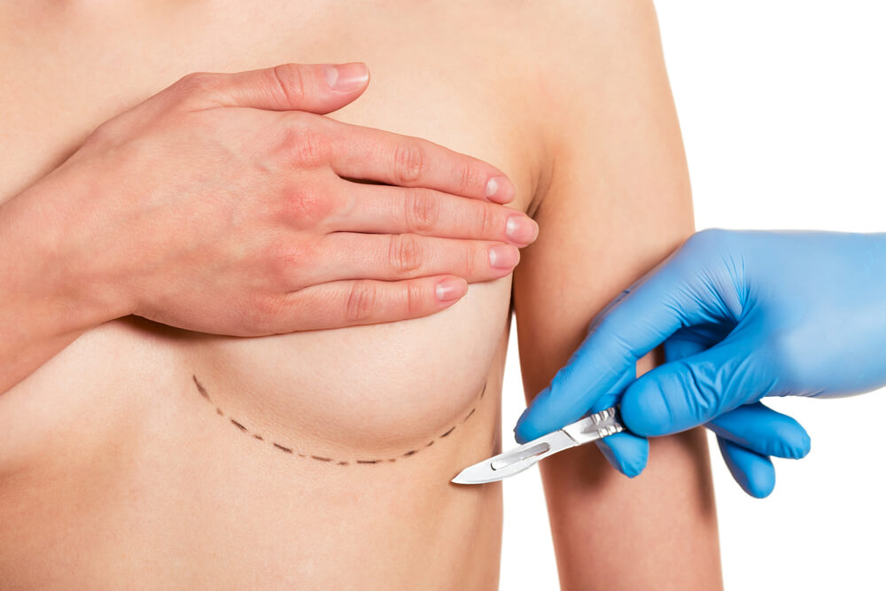 How to Find the Best Breast Surgeon in Miami