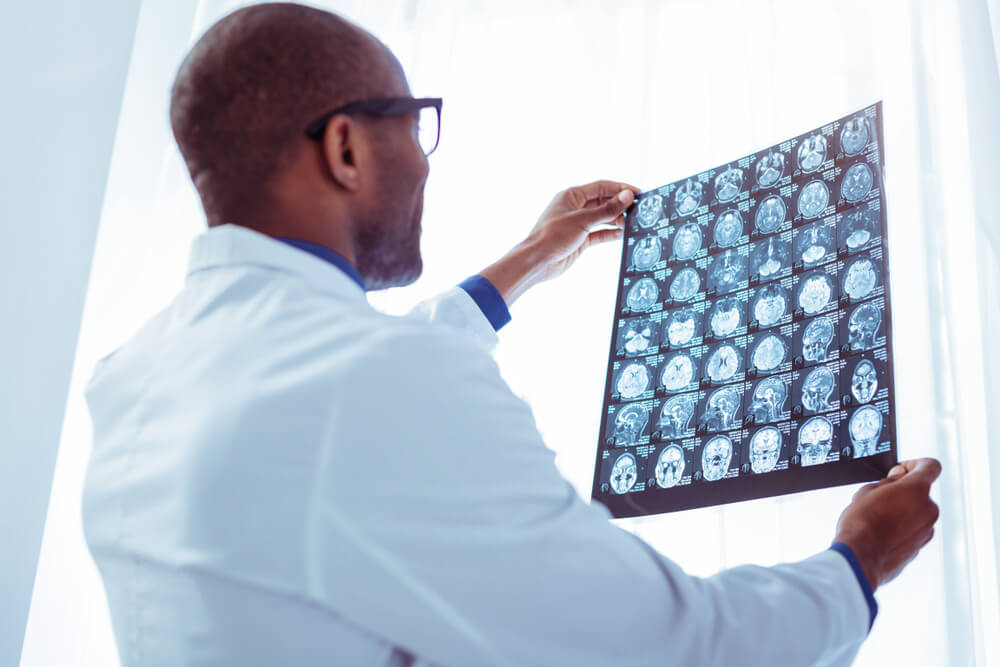 Professional Male Oncologist Looking at the X-Ray Photo While Checking the Brain Tumor