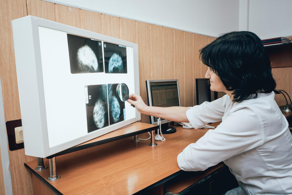 Doctor Examine Mammography Test. Medical Equipment at the Hospital.