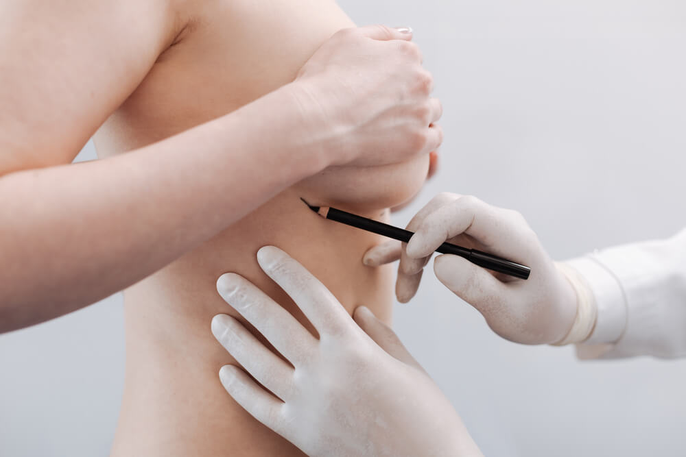 Delicate Scrupulous Plastic Surgeon Drawing Special Marks