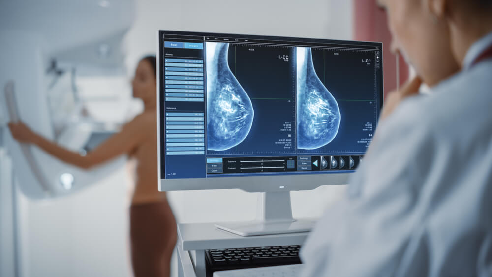 Computer Screen In Hospital Radiology Room Beautiful Multiethnic Adult Woman Standing Topless Undergoing Mammography Screening