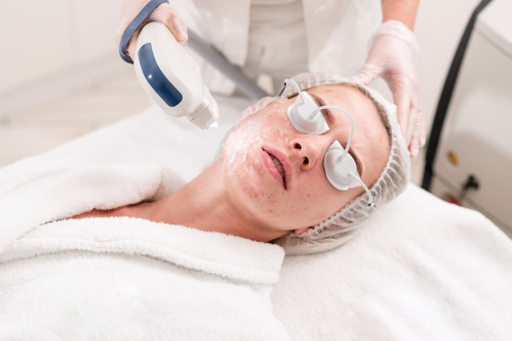 Woman getting acne laser treatment