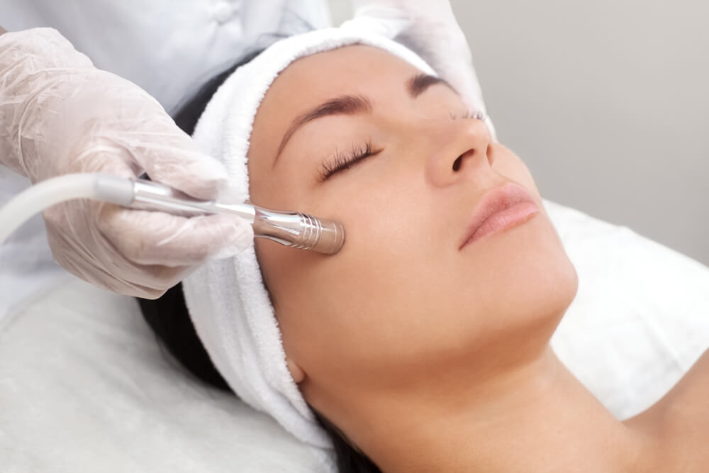 Do You Need Acne Scar Treatment in Hialeah