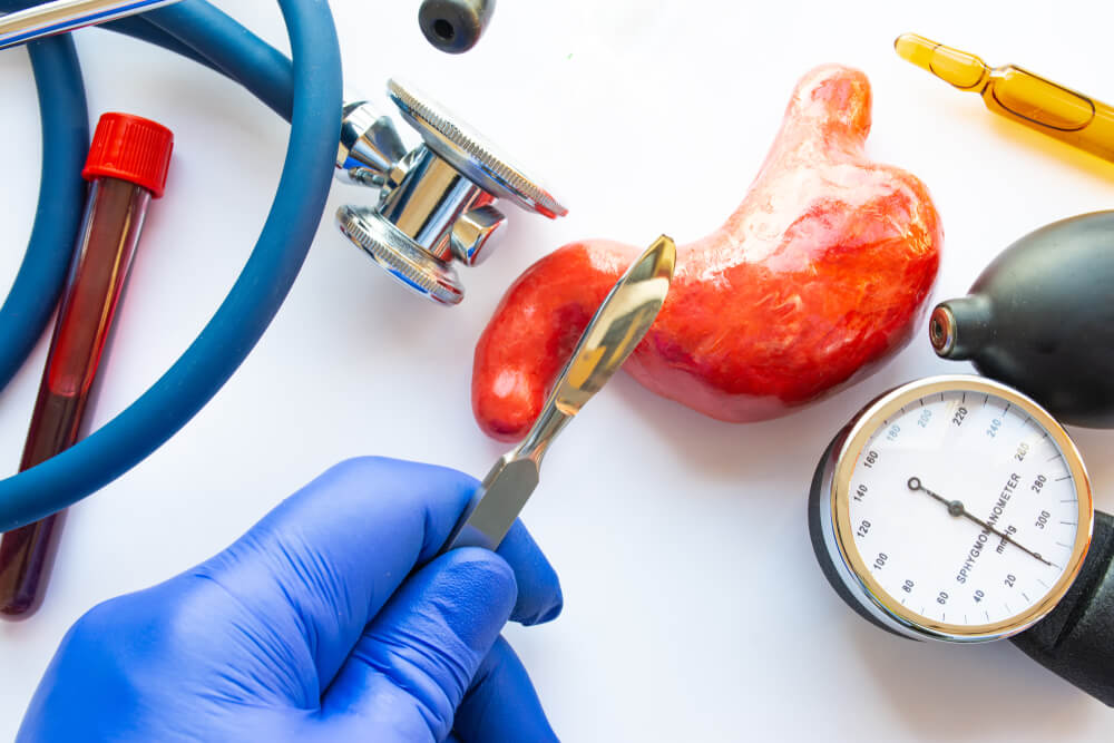 What Is Gastric Sleeve Surgery