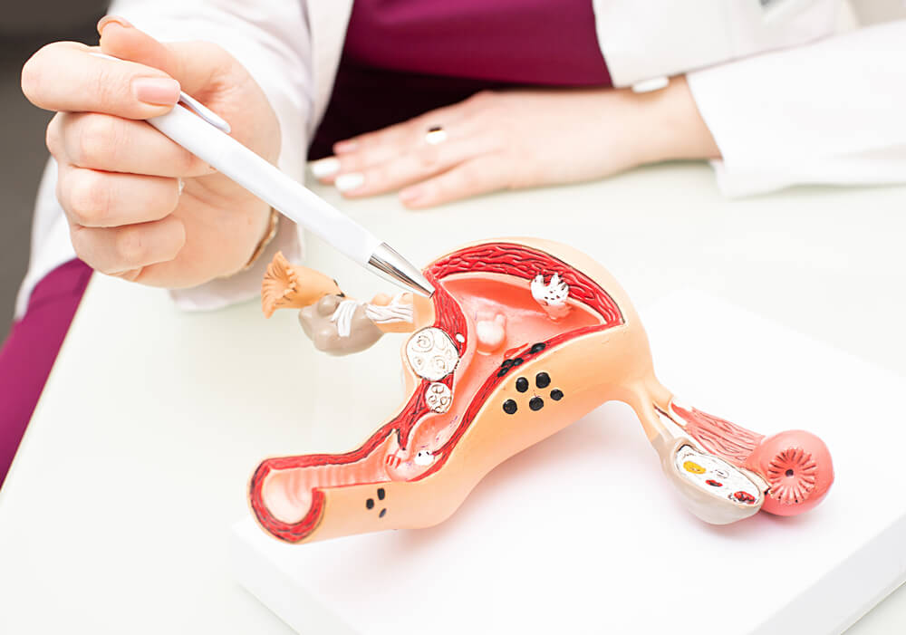 Gynecologist Showing Uterine Structure on a 