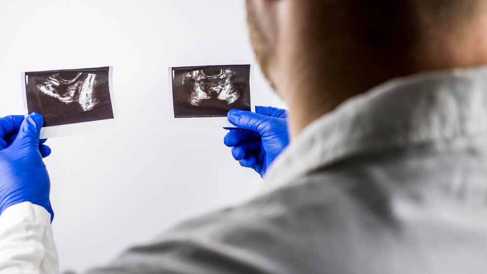 The Doctor Examines the Ultrasound Images of the Prostate Gland,Prostate Pictures in the Hands of a Medical Worker,on a White Background
