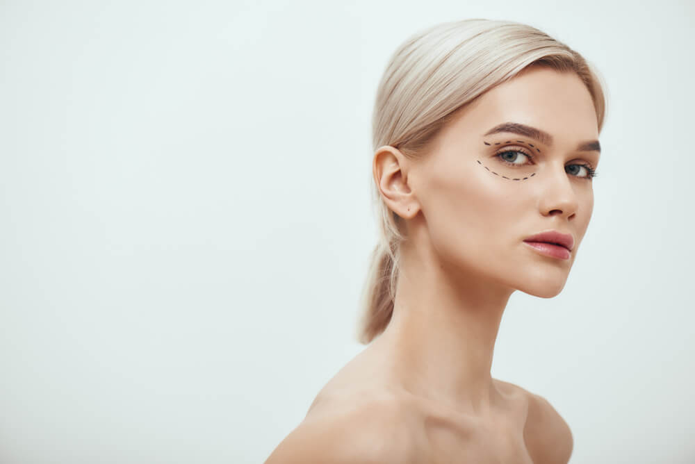  Beautiful and Young Blonde Woman With Black Surgical Lines on Eyelids and Under Eyes Looking at Camera