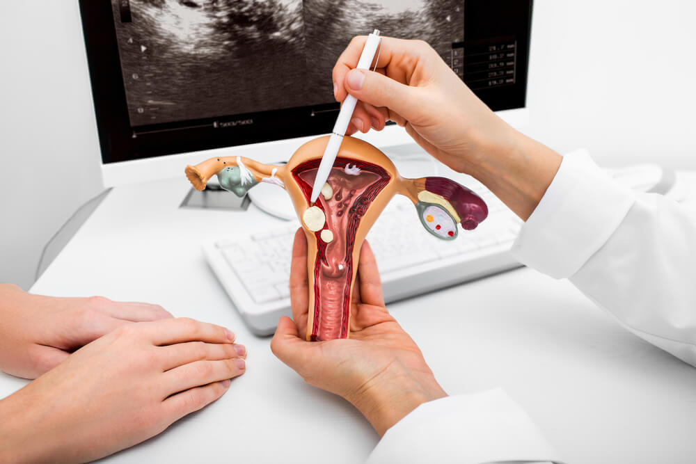 Close-up Anatomical Model of the Uterus With Pathologies.