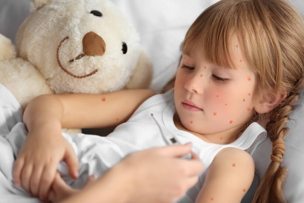 Mother Measuring Temperature of Little Girl With Red Pimples. Chicken Pox Concept