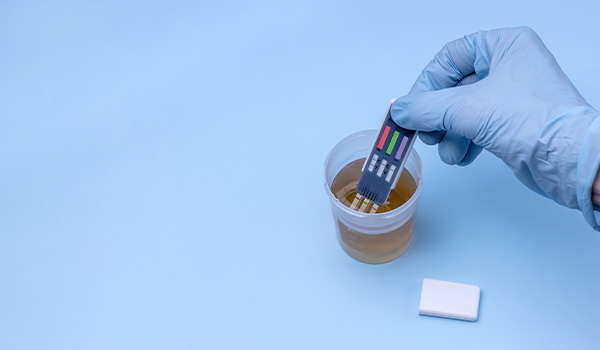 Urinalysis-and-Urine-Culture-img