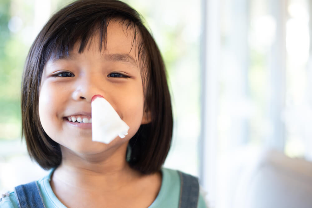 Asian Girl Nosebleed With Smile Face Medical And Health Care Concept Background