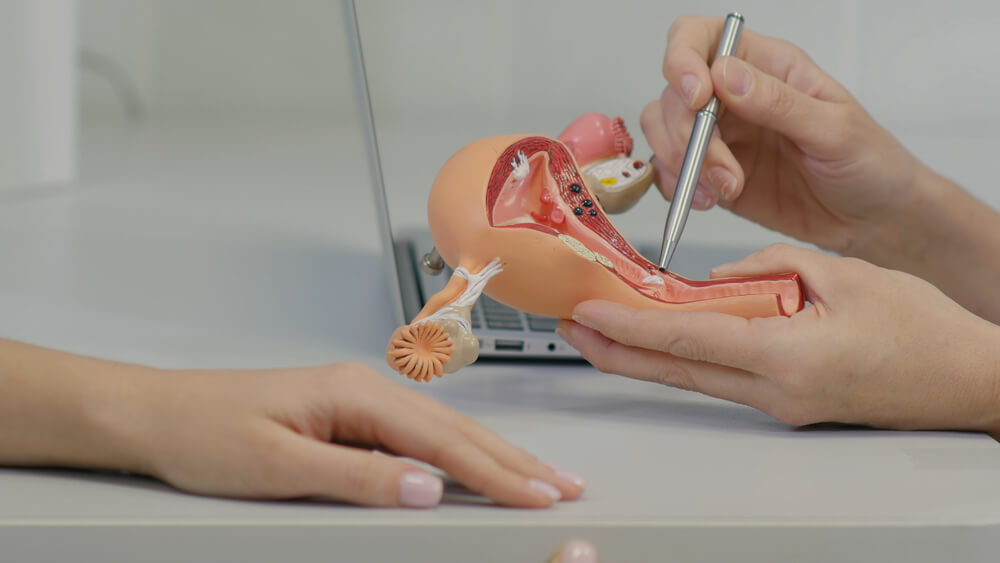 Gynecologist Doctor Consulting Patient Using Uterus Anatomy Model